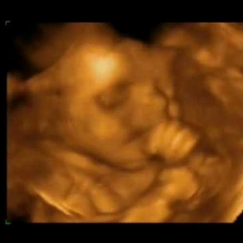 Find Joshua Jacob Wirth Phone Number, Location, Email, and more on Intelius